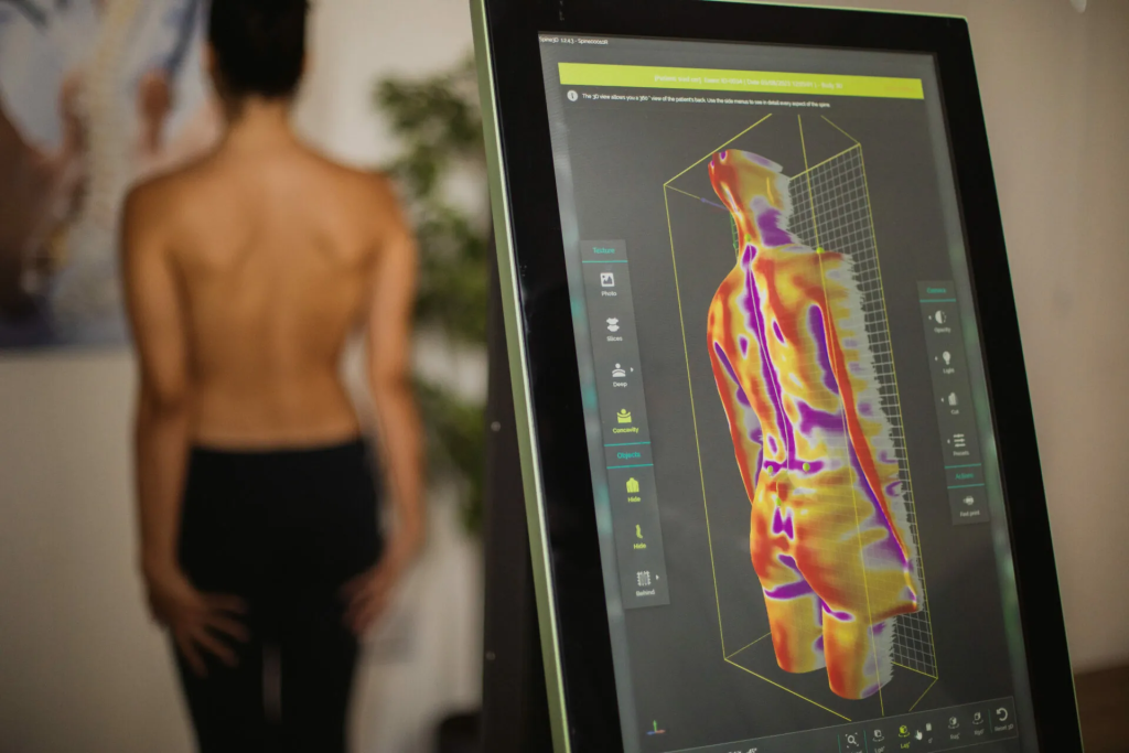 сканер spine 3D