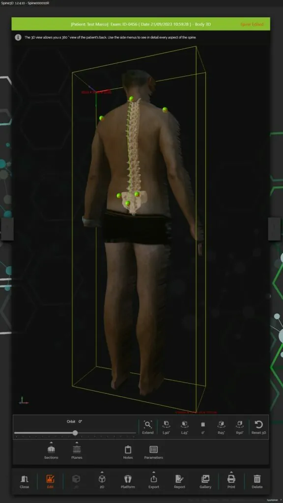 знімок сканера spine 3D