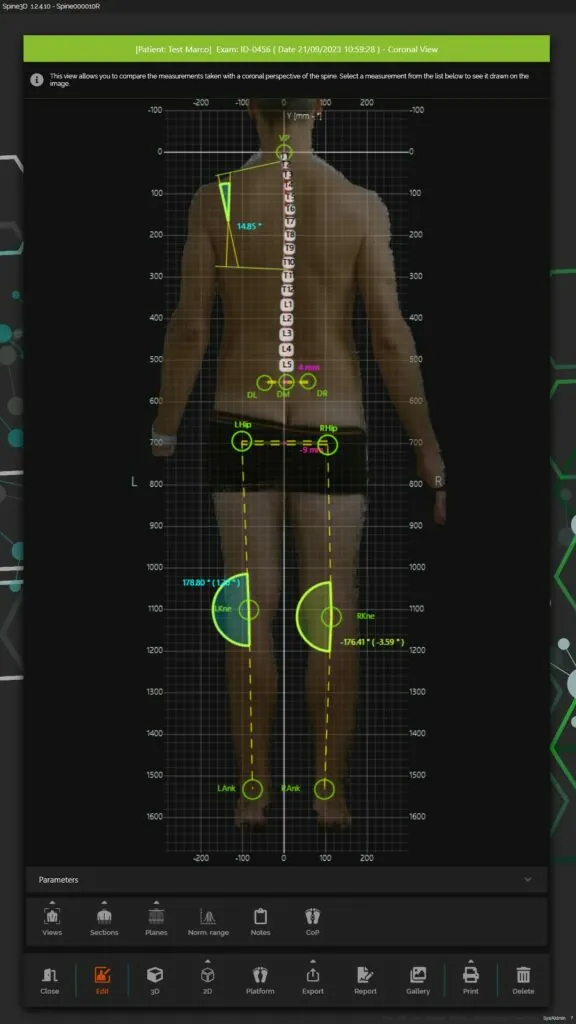 знімок сканера spine 3D